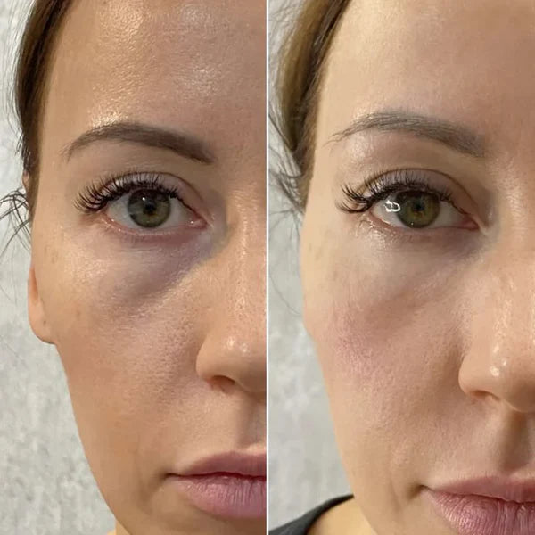 Susana L., 47