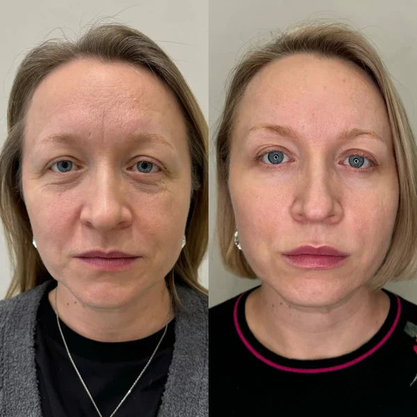 Teresa A., 63