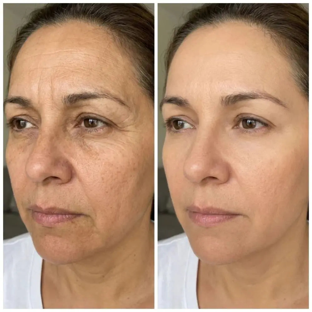 PDRN MULTI Bálsamo Volumen y Brillo Sin Agujas Lisse