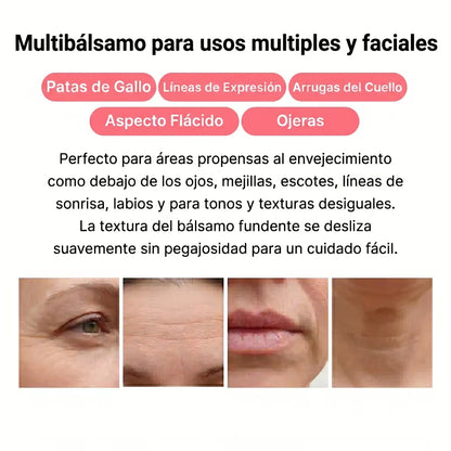 PDRN MULTI Bálsamo Volumen y Brillo Sin Agujas Lisse